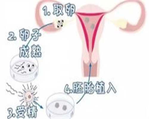 北京代生产子公司哪家好 北京试管婴儿成功率最高的医院？(北京试管婴儿成功