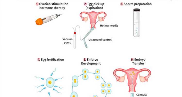 北京助孕代怀中心|北京助孕机构哪家好？北京试管试管助孕机构正规流程是关